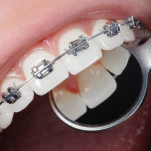 Orthodontics